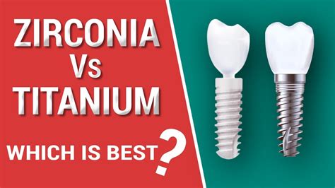 Zirconia Vs. Titanium Dental Implants | Doovi