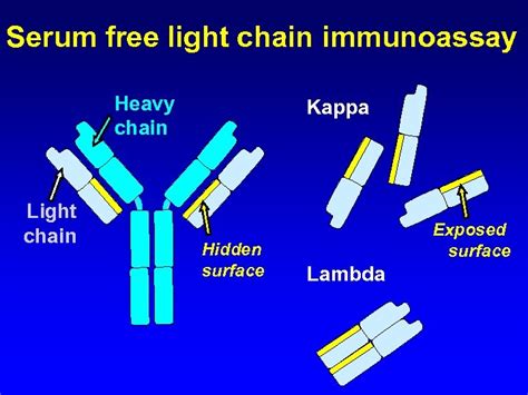 International consensus on serum free light chain analysis