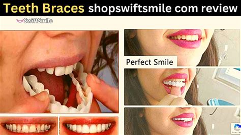 Shopswiftsmile! Swift Smile Teeth Reviews | Facts You Must Know Before Ordering It !!! - YouTube