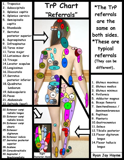 Trigger Point pain referral chart. A trigger point is a section of your ...