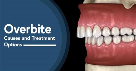 What Is an Overbite? Symptoms, Treatment, and More