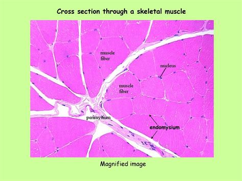 Skeletal Muscle Cross Section Labeled