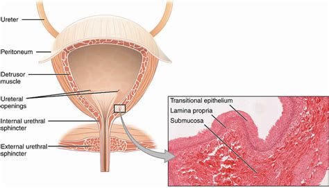 Hemorrhagic cystitis causes, symptoms, diagnosis, treatment & prognosis