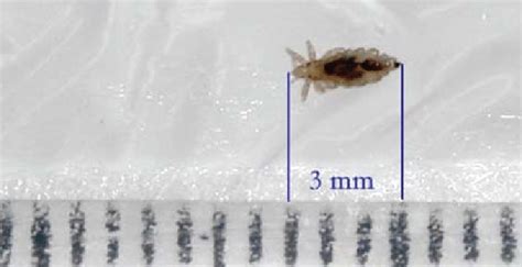 , 2: The head louse is long about 3 mm (), whereas the length of the... | Download Scientific ...