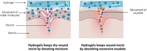 Schematic illustration of hydrogels promoting wound healing by their ...