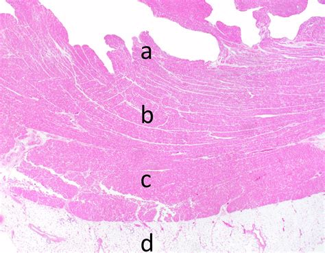 Heart Layers Labeled Histology