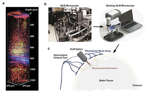 Two-Photon Imaging Monitors Brain Synapses During Prolonged Anesthesia ...