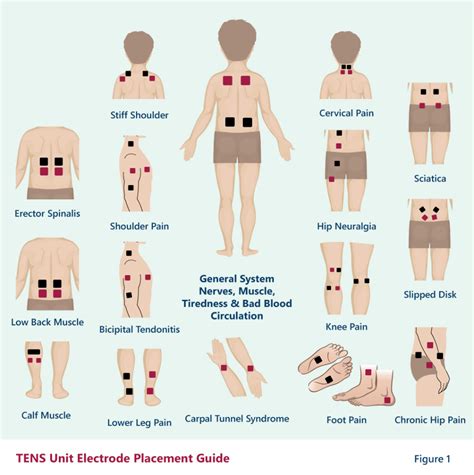 tens unit guide Tens Unit Therapy, Magnet Therapy, Migraine, Tens Unit Placement, Lower Leg Pain ...