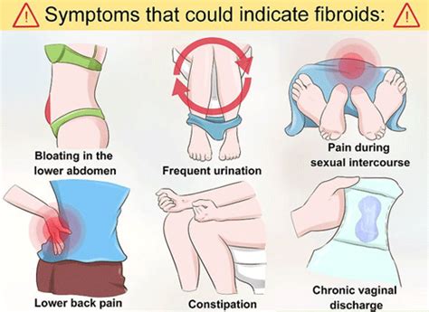 Uterine Fibroids | Varicose veins | Vascular surgeon | Stroke | DVT ...