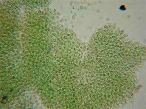 Microcystis aeruginosa ~ Everything You Need to Know with Photos | Videos