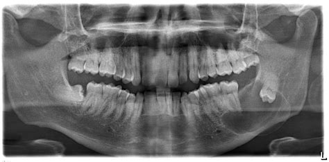 Dental Library: February 2017