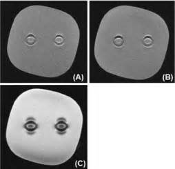 MRI of gelatin phantom containing circle contact lenses showed... | Download Scientific Diagram