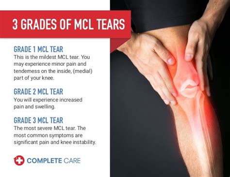 MCL Tears: Symptoms, Causes, Treatment & More