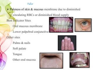 General & extraoral examination.pptx