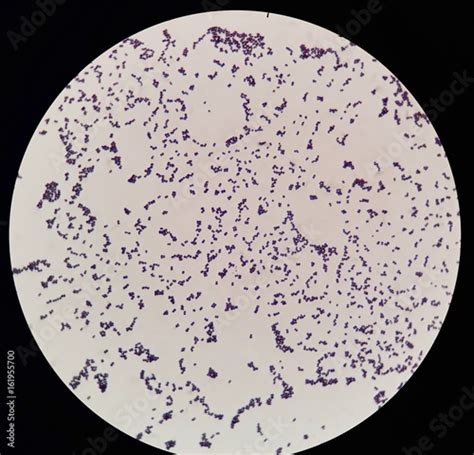 Smear of gram positive cocci bacteria under 100X light microscope ...