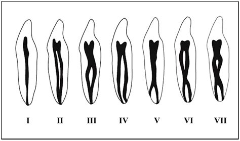 Mandibular Central Incisor