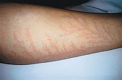 Incredible photos reveal what happens to your SKIN if you're struck by ...