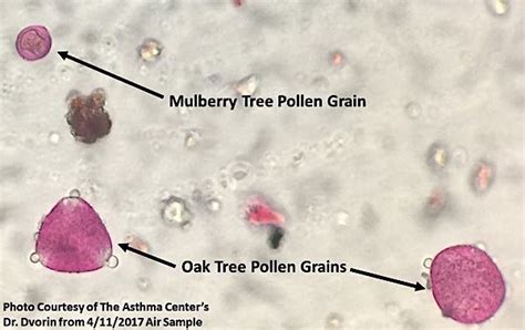 Pine Pollen Microscope