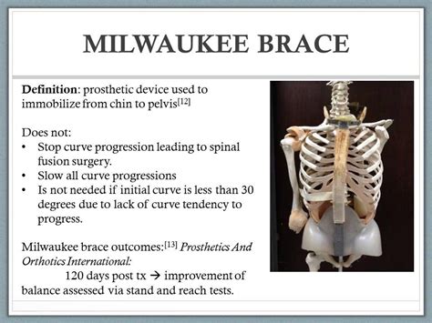 Scheuermanns kyphosis Video class of 2015 | Milwaukee brace, Milwaukee, Spinal fusion surgery