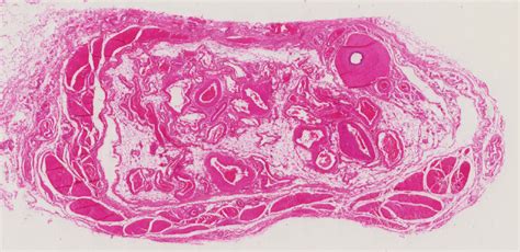 histology of spermatic cord Diagram | Quizlet