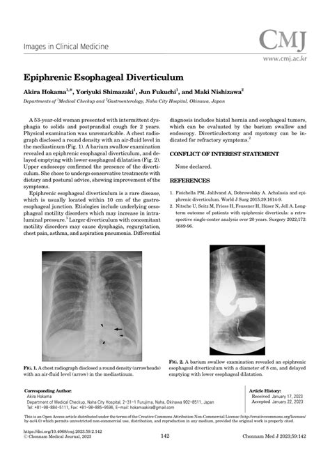 (PDF) Epiphrenic Esophageal Diverticulum