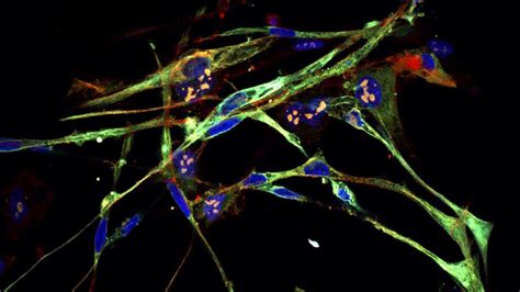 Muscle cancer cells converted into muscle cells - Techzle