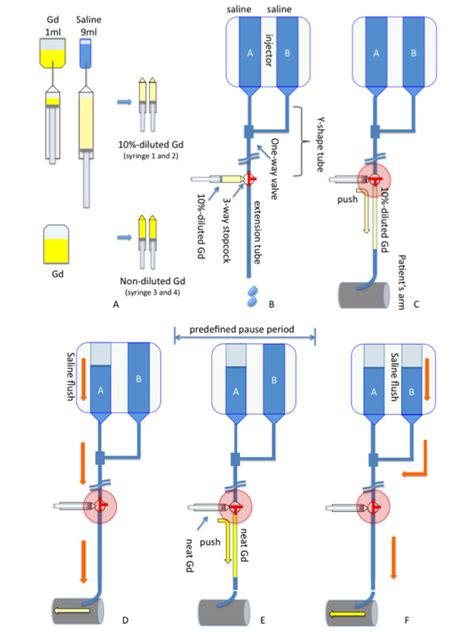 Preparation of the dual-bolus injection scheme for injectors with a ...