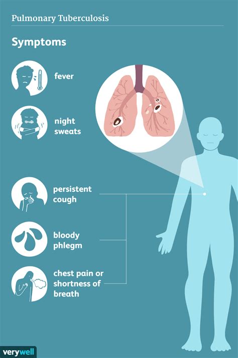 Tuberculosis: Signs, Symptoms, and Complications