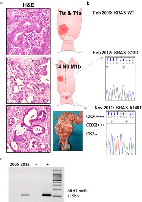 Characterization of tumor specimens a Representative histological... | Download Scientific Diagram