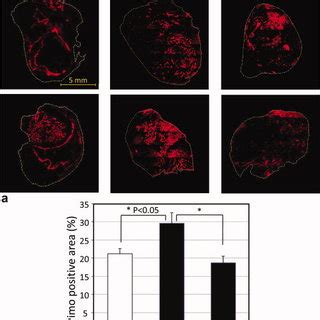 Immunostaining of hypoxia marker pimonidazole of representative tumors ...