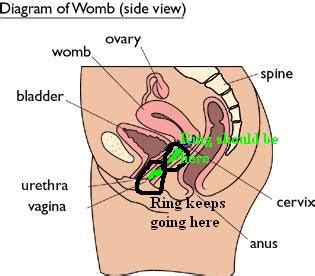 Nuvaring Diagram - Wiring Diagram Pictures