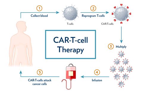 Research project aims to make CAR-T-cell therapy safer and more ...