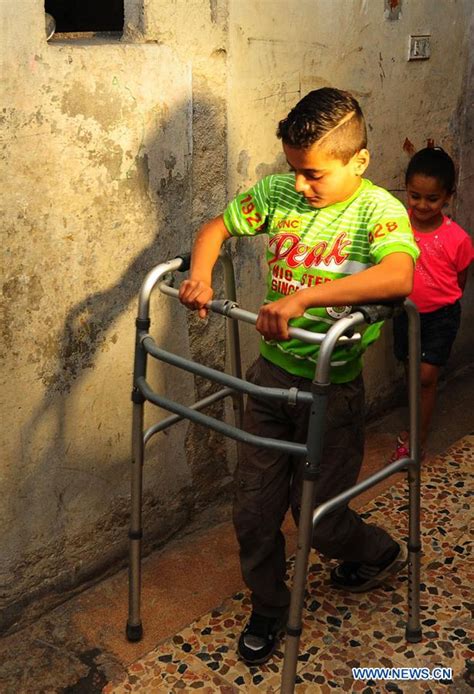 Feature: Hopeful Syrian boy moves on despite paralysis left by war - Xinhua | English.news.cn