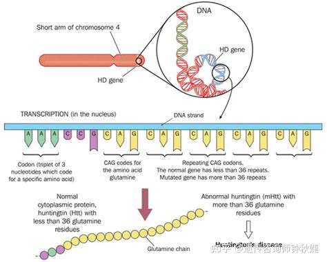 亨廷顿病（HD）的遗传检测 - 知乎