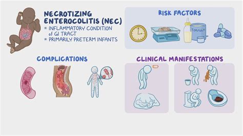 Necrotizing enterocolitis: Nursing - Osmosis Video Library