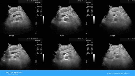 Abnormal Pancreas Ultrasound