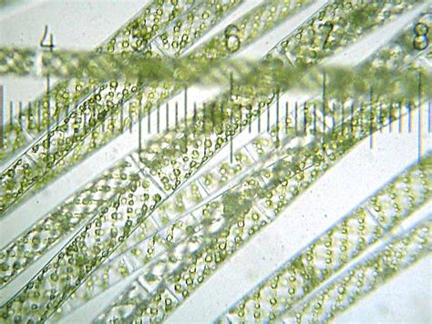 Spirogyra | Spirogyra diagram, Amazing nature, Biology