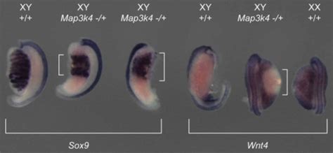 Ovotestis development in embryos haploinsufficient for | Open-i