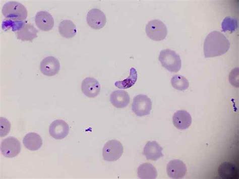 Plasmodium falciparum | Learnaboutworld