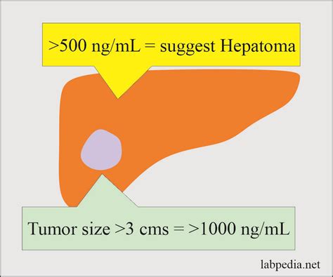 Tumor Marker:- Part 8 - Alpha-Fetoprotein (AFP) - Labpedia.net