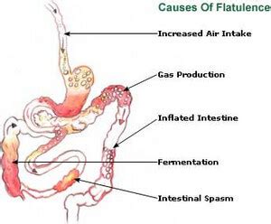 Excessive Bloating and Belching (Burping) - Causes, Management, Remedies