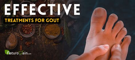 Gout Natural Treatment - 8 Effective Treatments for Gout Symptoms Relief