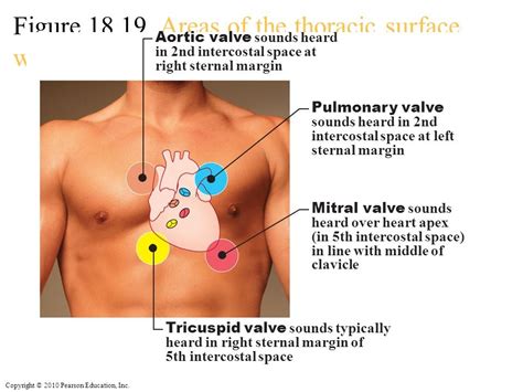 Mitral Valve Location Intercostal Space