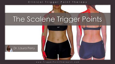 The Scalene Trigger Points: Upper Body Troublemakers ...