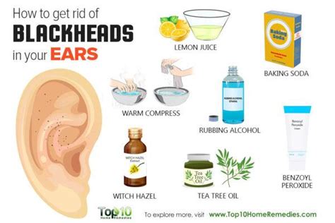 How to Get Rid of Blackheads in Your Ears | Top 10 Home Remedies