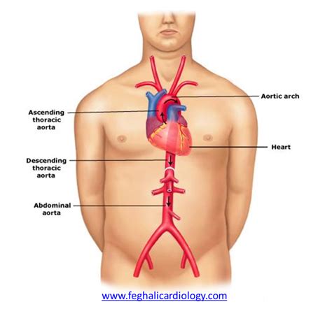 Solved The aorta is a large artery that ascends from the | Chegg.com