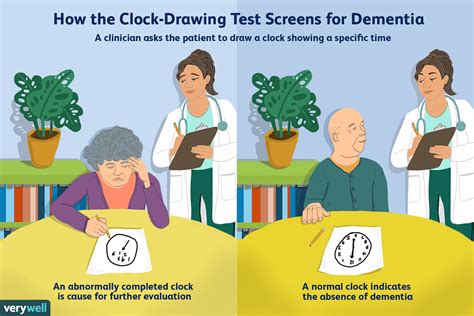 How the Clock-Drawing Test Screens for Dementia