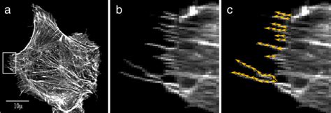 Images of cells displaying filopodia. (a) Fluorescence confocal... | Download Scientific Diagram