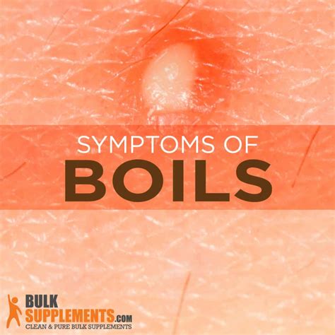 Causes Of Boils On Stomach