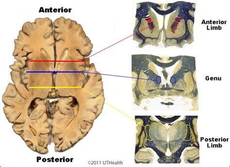 Neuroanatomy Online: Lab 2 - Internal Organization of the Brain ...